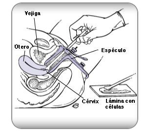 dra-cisneros-ginecologia-obstericia-pap